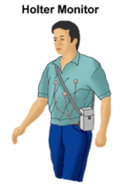 Holter Monitor